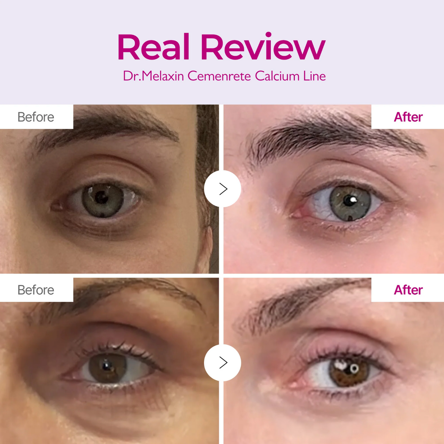Dr. Melaxin Cemenrete Calcium Eyecare Routine